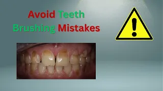 Avoid Teeth Brushing Mistakes