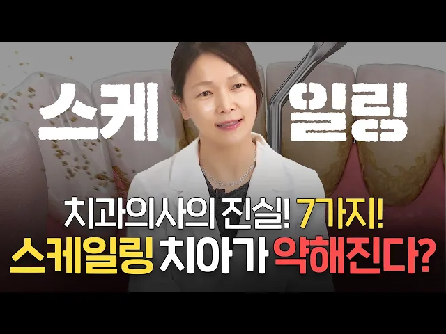 스케일링 하면 치아가 약해진다? 치과가 말 안 해주는 진실 7가지