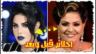 شاهد نجوم الثمانينات قبل الشهرة وبعدها تغيرات صادمة جدا وشباب دائم 