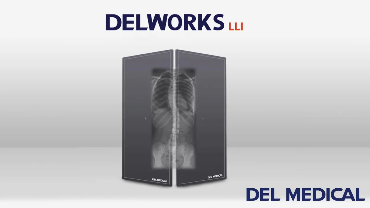 DELWORKS LLI full length flat panel detector by DEL MEDICAL