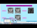 An Efficient Quadtree-based Block Truncation Coding for Digital Image Compression