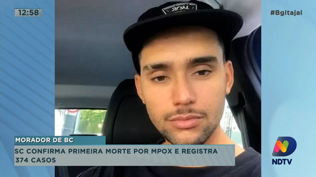 SC confirma primeira morte por mpox; vítima é de Balneário Camboriú