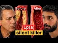 Cardiologist Explains How To Lower Lp a and Avoid Heart Attacks - Dr Joel Kahn MD