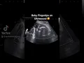 Download Lagu See those little fingertips? So cute 🥰#jerbearimaging #fingertips #mobilebusiness #pregnant #baby