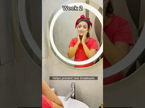 🧴এটা লাগিয়ে আমি আমার সমস্যার সমাধান পেলাম   #preventpimple | Bong Girl Monti #bengalicomedy #comedy