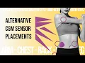 Alternative CGM Sensor Sites