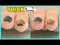 Thick Ugly Nails QUICK HACK To Thin