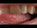 Close Up Lips and Mouth tour