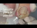 Download Lagu Vídeo completamente relaxante (removendo muita pele) #satisfying #nails