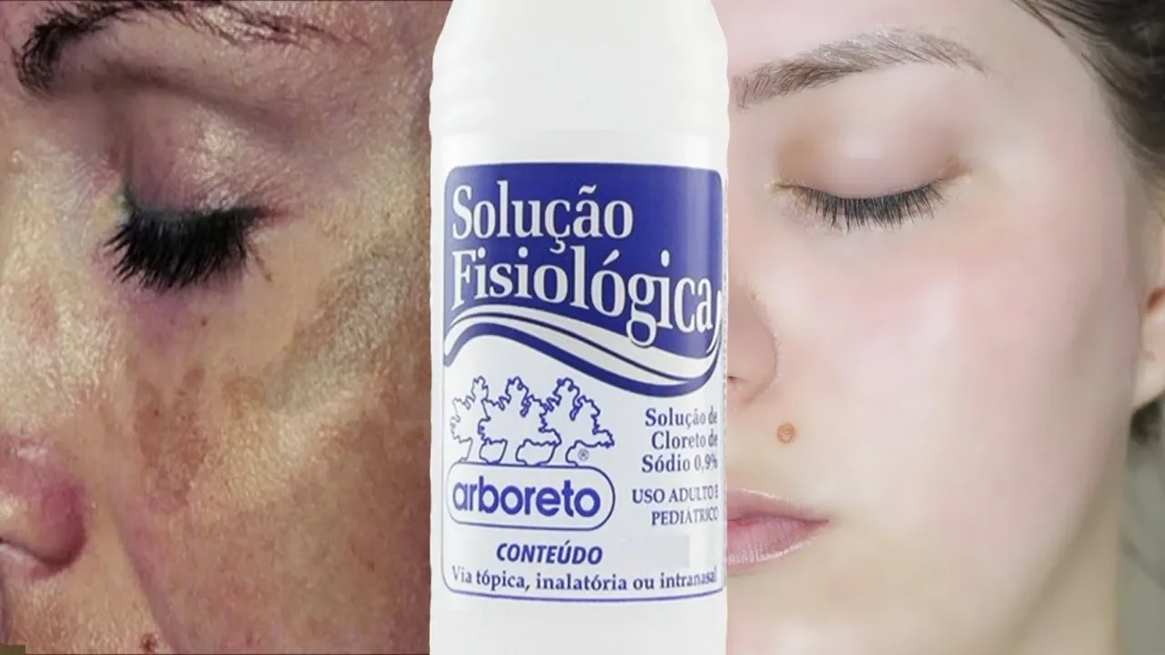 COMO CLAREAR MANCHAS DA PELE EM APENAS 1 SEMANA (NATURALMENTE)! por Julia Doorman