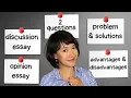 Can you EASILY answer any IELTS Writing Task 2 question