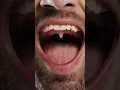 Channel