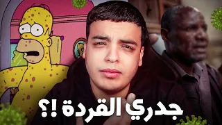 جدري القردة دخل المغرب 