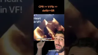 شکل واقعی قلب در هنگام ایست قلبی  پزشکی دندنها