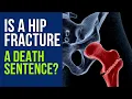 Is a Hip Fracture a Death Sentence