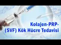 Download Lagu Kolajen-Glikozaminoglikanlar-PRP- SVF Kök Hücre Tedavisi Eklem Kıkırdağını İyileştirebilir mi?