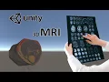 Analyzing MRI Imaging in 3D with Unity and 3D slicer Plica syndrome