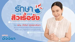 สาเหตุหลักที่ทำให้เกิดสิวเรื้อรังมีอะไรบ้าง