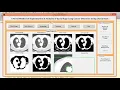 Lung Cancer detection using CAD matlab project source code