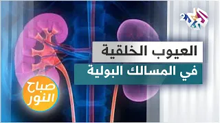 العيوب الخلقية في المسالك البولية ما هي أنواعها وكيف يتم معالجتها 