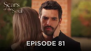 Scars Of The Soul Episode 81 Alaca English Subtitles 