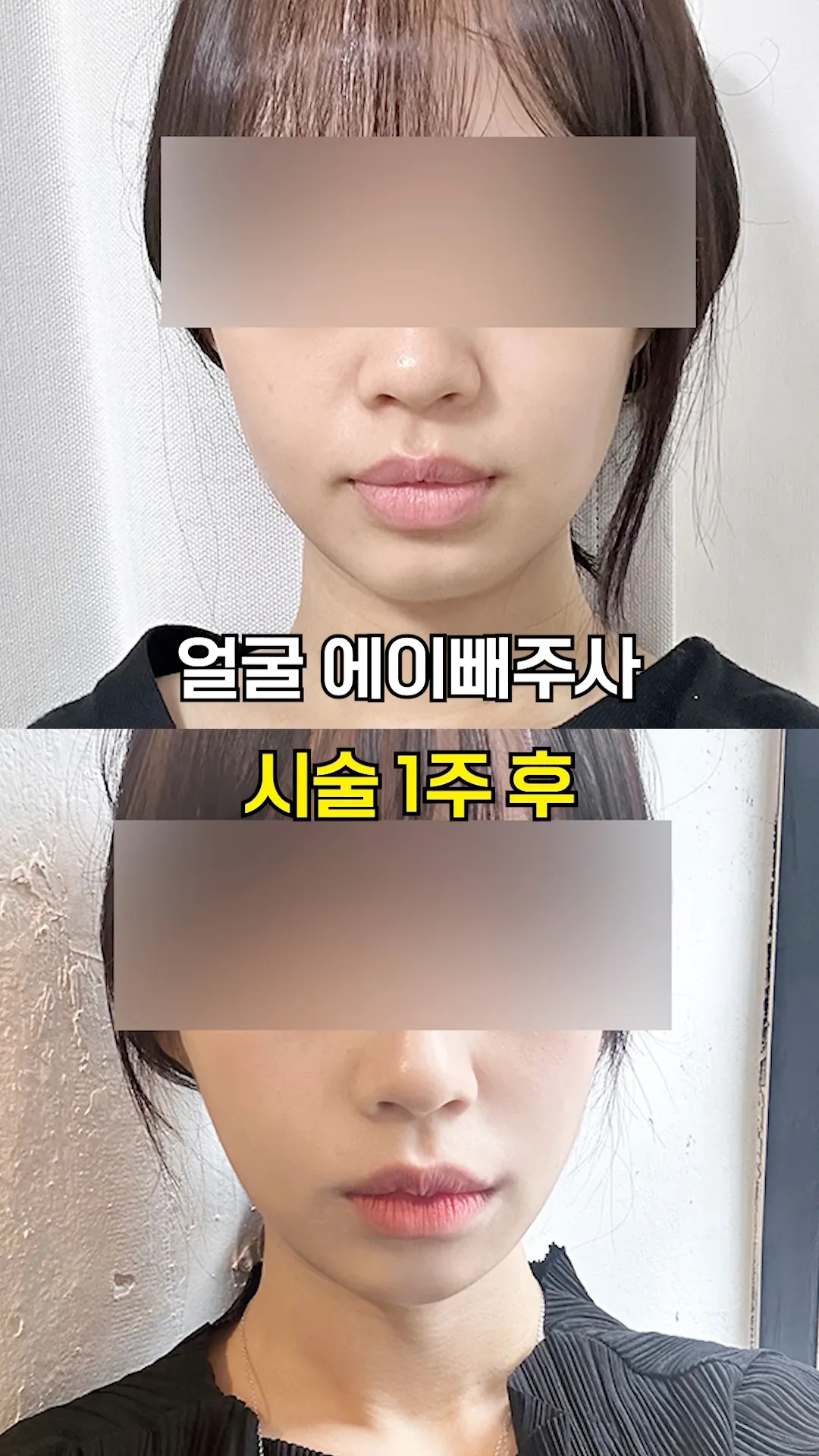 전후차이 실화?