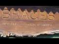 Braces of Bristol range open day
