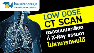  การตรวจคัดกรองมะเร็งปอดด้วย low dose CT Scan มีข้อดีอย่างไรเมื่อเทียบกับการเอกซเรย์ธรรมดา 