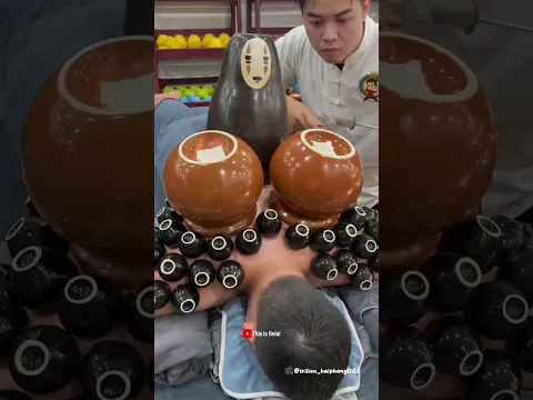 He Trusted His Therapist and Took a Nap… But Look What Happened Next!He Slept Through His Cupping