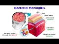 Brain Damage and Neuroplasticity