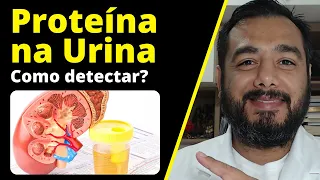 O que causa proteinúria? Qual exame detecta perda de proteína na urina? Microalbuminúria | Albumina