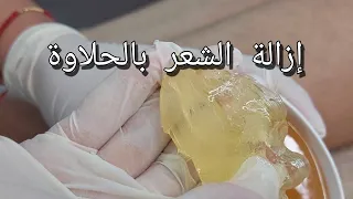 احسن طريقة لإزالة الشعر بالحلاوة حلاوه Esthétique épilation 