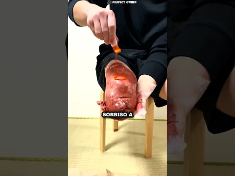 ❤️ Ele faz o filho sorrir com sua prótese