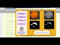 Diabetic Retinopathy Detection using Convolutional Neural Network CNN