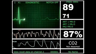 Hospital Monitor with FlatLine L