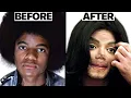 Michael Jackson Nose Job Plastic Surgeries - Surgeon Reacts