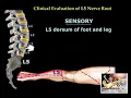 Neurological Evaluation Of The Lumbar Nerve Roots - Everything You Need To Know