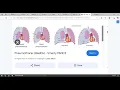 Module 3 exam review - PART 1 UEMR EMT