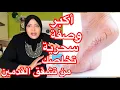 Download Lagu أقسم بالله هتدعولي👠أقوي وصفة سحرية تخلصك من تشققات القدمين🦶🦶 
