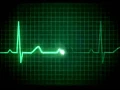 Download Lagu Heart Sound EKG Hospital Herzschlag