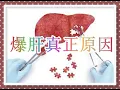 Download Lagu 「累到要爆肝」？醫生分析致死率高的「爆肝真正原因」！（有字 幕）
