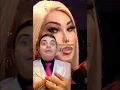 Gynecologist answers Should trans women go to the gynecologist