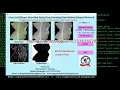 Corn Leaf Disease Detection Using CNN With Source Code Detection of Corn Leaf Disease Python Project