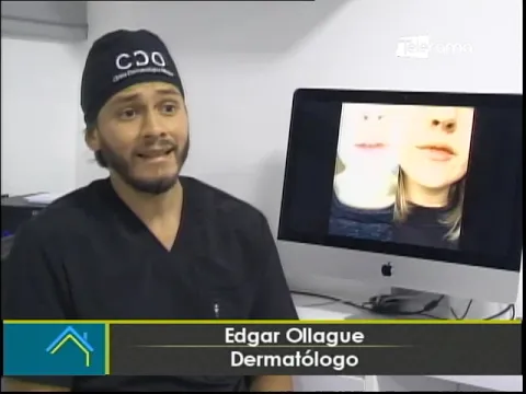 Acné por uso de mascarillas ¿Cómo prevenirlo?