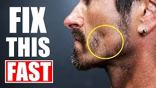 The FASTEST Way to Fix a Patchy Beard