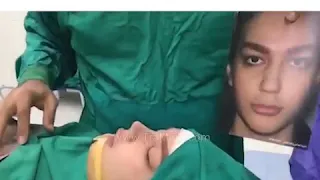 نتيجة عملية تجميل الأنف اللحمی مباشرتا بعد العملیة 