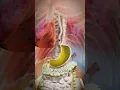 Download Lagu Acid Reflux Explained 🤔