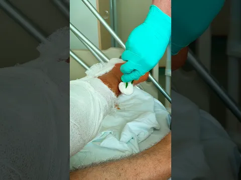 СКОЛЬКО СТОИТ ОПЕРАЦИЯ В МОСКВЕ