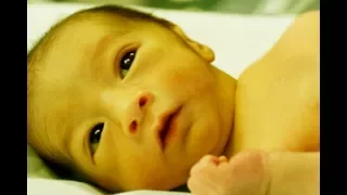 اليرقان أو الصفرة عند الطفل أعراضها وعلاجها دقائق لصحتك 