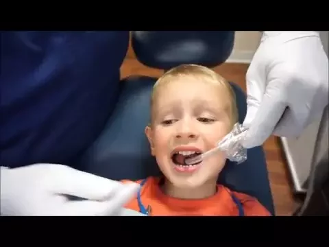 Fluoride Varnish Application